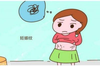 ​为什么有妊娠纹呢 如何去除妊娠纹呢