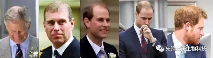 趣读丨有的英国男人表面上看起来风光无限，背地里已经秃了