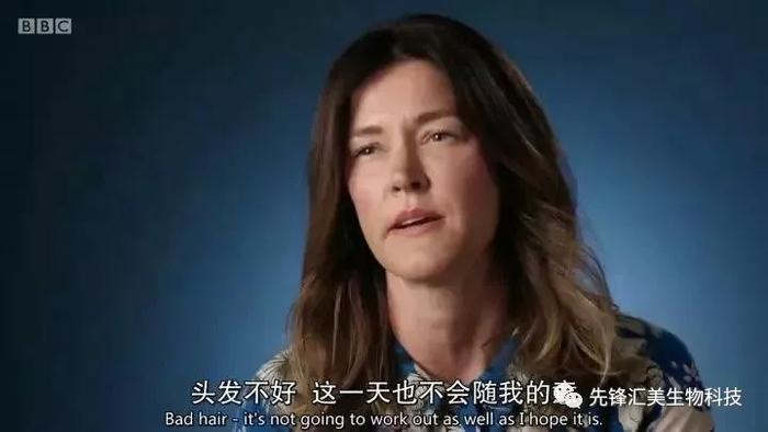 趣读丨有的英国男人表面上看起来风光无限，背地里已经秃了