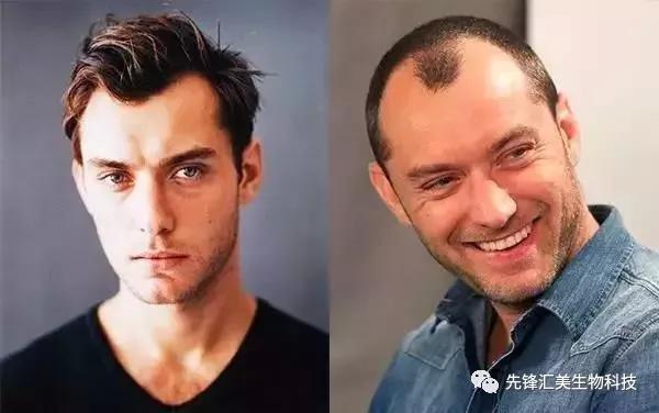 趣读丨有的英国男人表面上看起来风光无限，背地里已经秃了