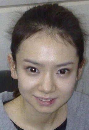 戚薇整容前照片（明星整容前后盘点对比）
