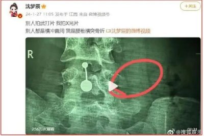 ​多次公开“表白”吴昕，却与美女主播相恋到结婚？