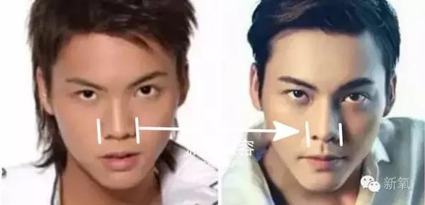 陈伟霆整容,蒜头鼻照片,本文共(3454字) 陈伟霆整容,蒜头鼻照片,本文共(3454字)