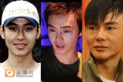 ​侣皓吉吉整容前后，整容失败图片