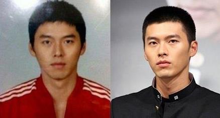 玄彬整容过哪里 玄彬整容前后对比照