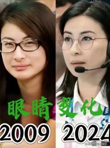 ​整容疑云？郭晶晶的眼眸，岁月流转中的秘密蜕变！