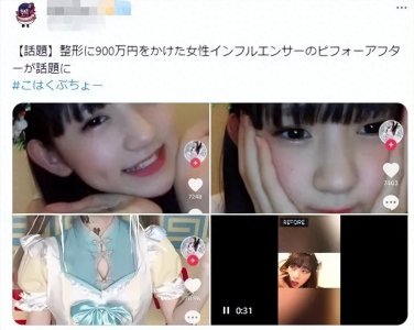 ​15岁少女整容失败成‘蛇精’，最狠却是她妈妈